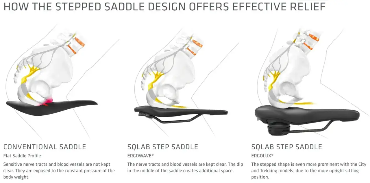 Vergleich von Fahrradsätteln: Konventionell vs. SQLAB Step Saddle. Hilft bei Sitzknochenschmerzen nach Radfahren durch Druckentlastung.